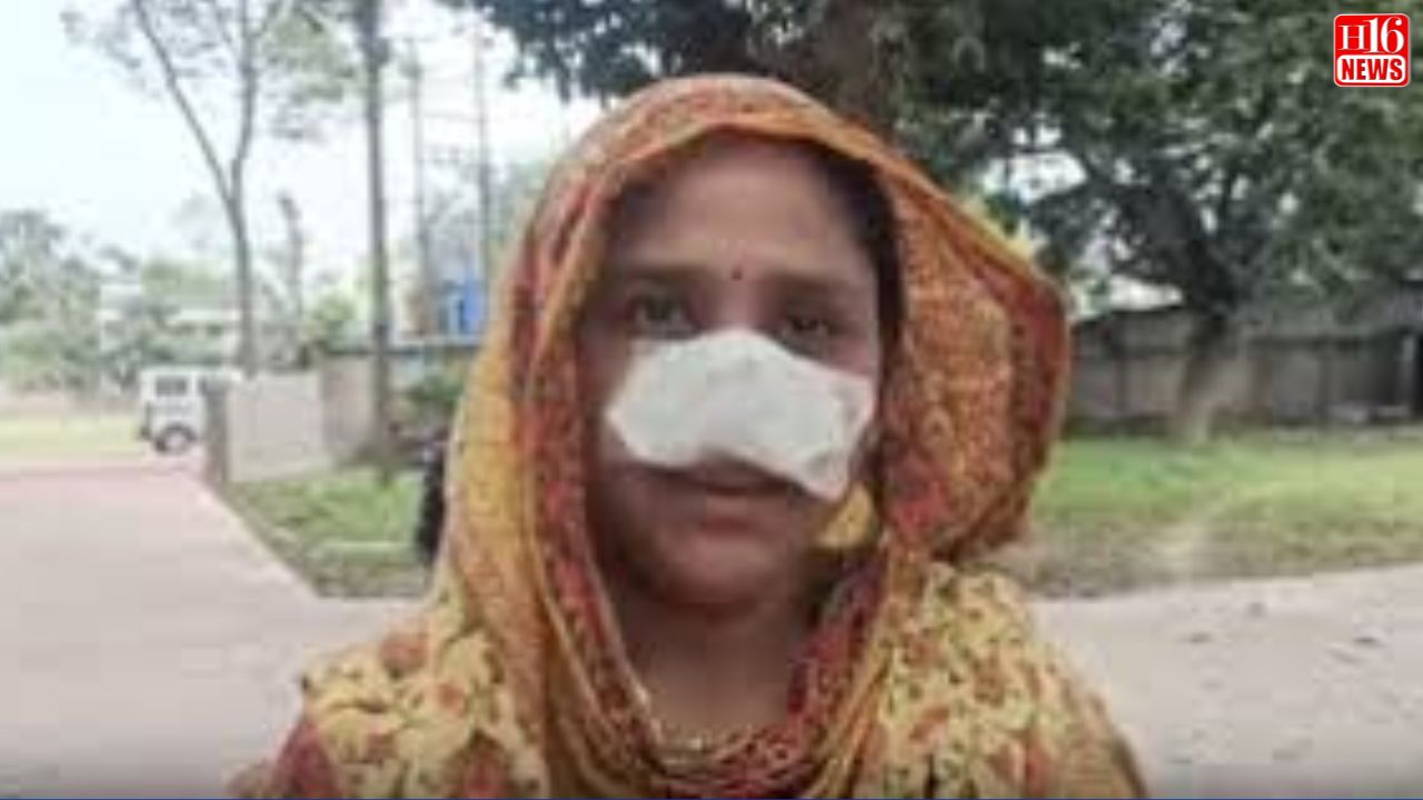 Often Praising, Bengal Man Bites Off And Swallows Wife's Nose